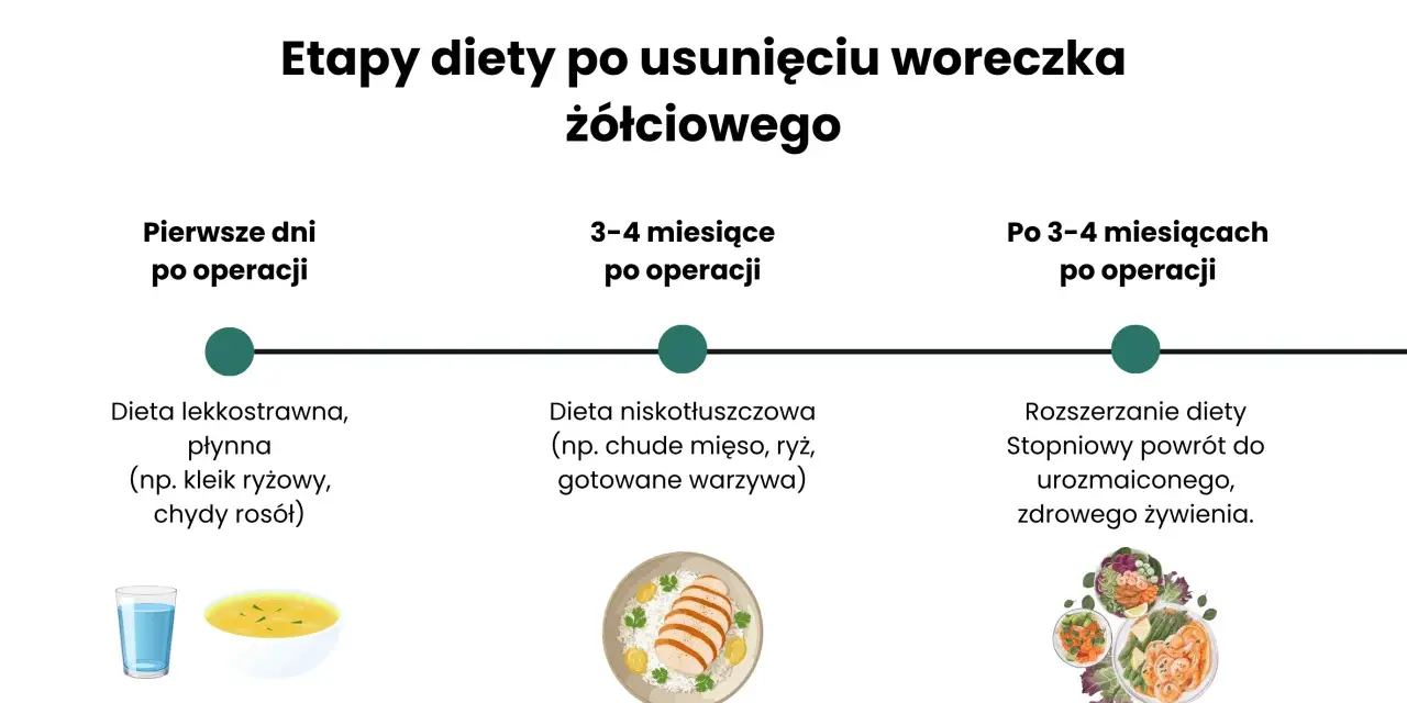 Etapy diety po usunięciu woreczka żółciowego: lekkostrawna, niskotłuszczowa, a potem stopniowy powrót do zdrowego żywienia.