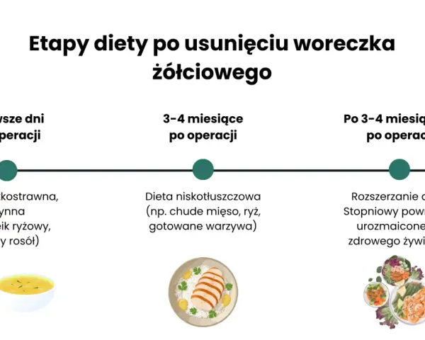 Etapy diety po usunięciu woreczka żółciowego: lekkostrawna, niskotłuszczowa, a potem stopniowy powrót do zdrowego żywienia.