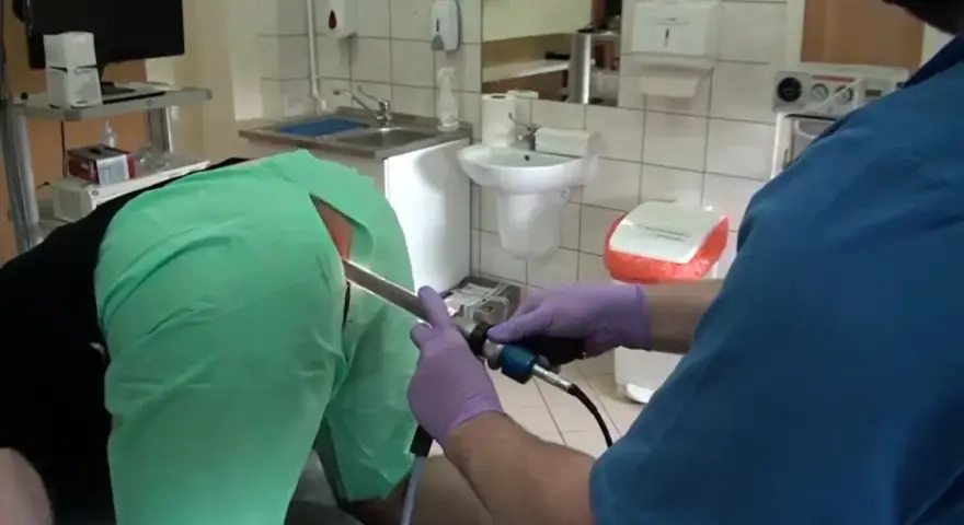 Lekarz w rękawiczkach wykonuje badanie jelit za pomocą endoskopu.